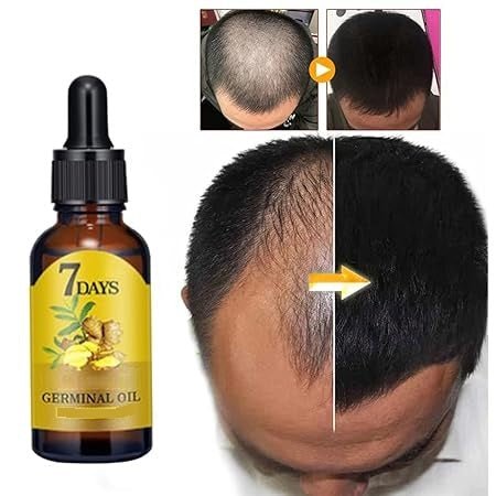 7 Day Ginger Hair Growth Oil (40ml) - Zambeel