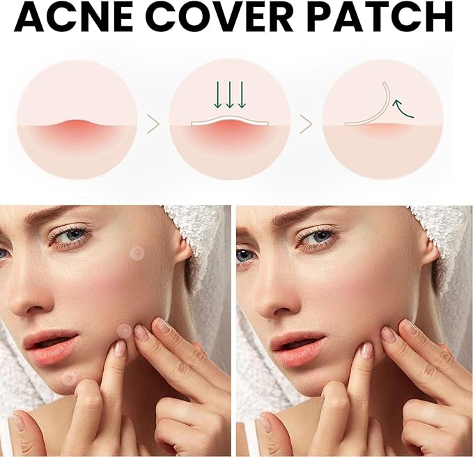 Acne Cover Patch (72pc)