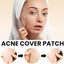 Acne Cover Patch (72pc)