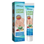 Lipoma Cyst Remover Cream (20g)