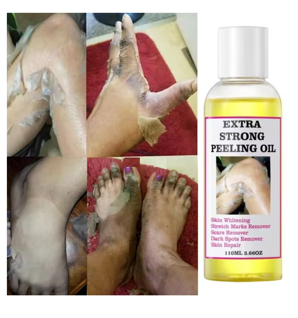 Peeling Oil (110ml)