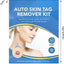 Acrochordon Skin Remover Kit - Zambeel