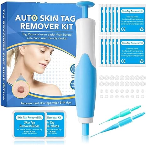 Acrochordon Skin Remover Kit - Zambeel