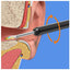 Earwax Removal Kit - Zambeel