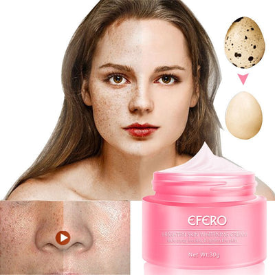 Efero Freckle Cream - Zambeel