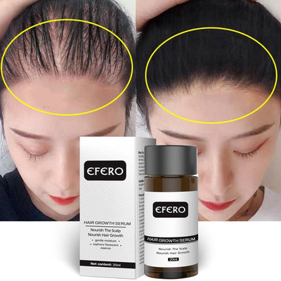 Efero Hair Growth Fluid - Zambeel