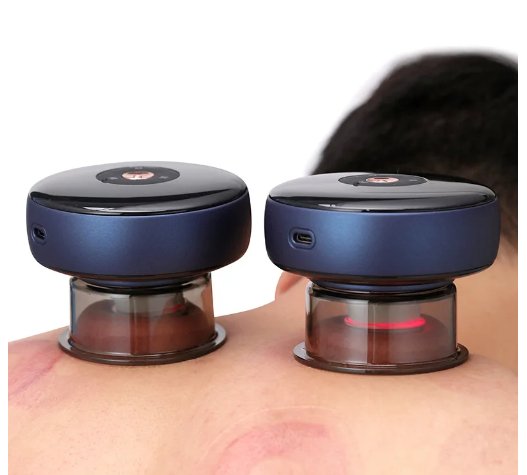 Electric Vacuum Cupping Massager - Zambeel