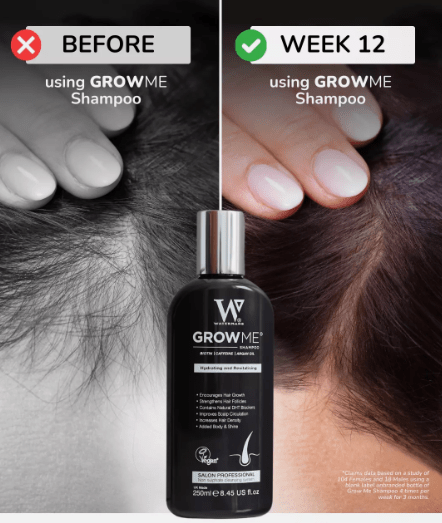 Hair Growth Shampoo(250ml) (Original) - Zambeel