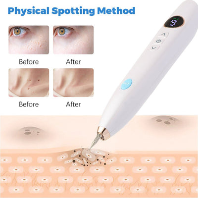 Laser Skin Tag Remover Face Mole Remove Plasma Pen Freckle Removal Machine Plasma Remove Scar Black Spot Face Wart Tattoo Device - Zambeel