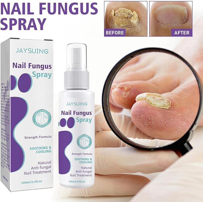 Nail Fungus Spray - Zambeel