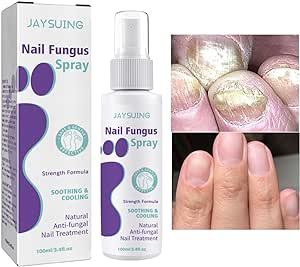 Nail Fungus Spray - Zambeel