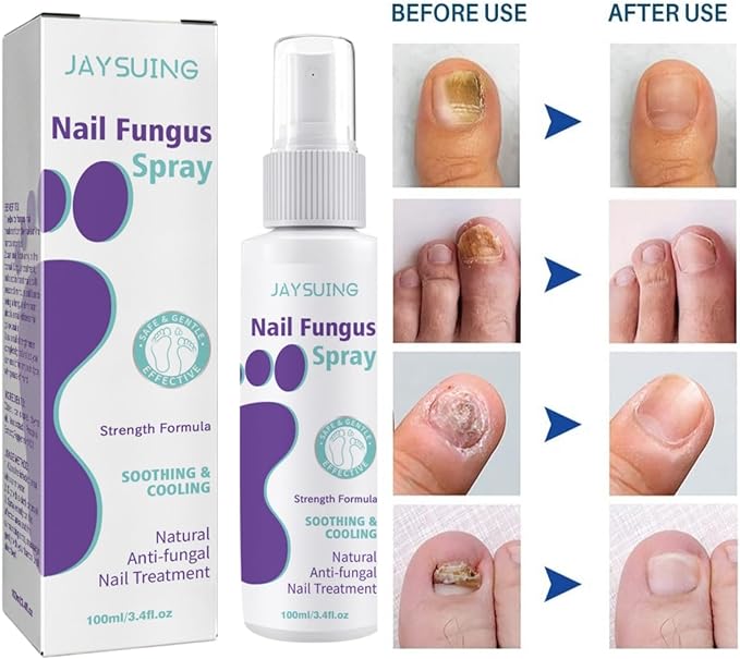 Nail Fungus Spray - Zambeel