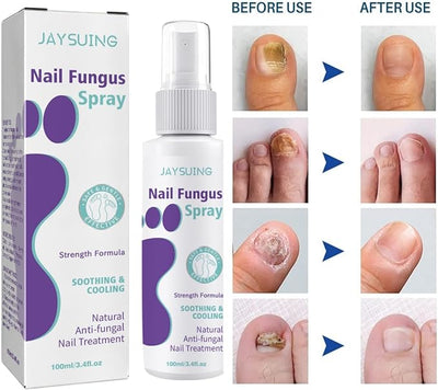 Nail Fungus Spray - Zambeel