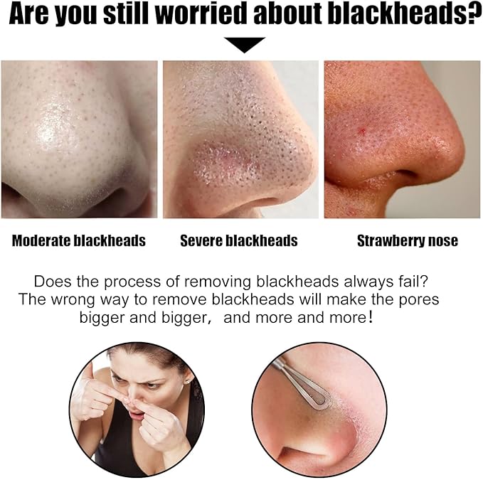 Nose Blackhead Strips - Zambeel