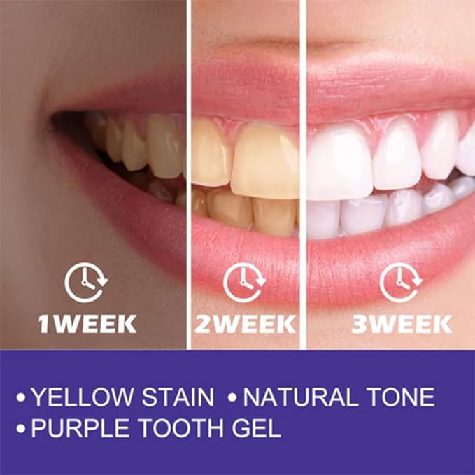 Purple Whitening Toothpaste - Zambeel