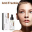 Anti Freckle Serum (30ml)