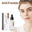 Anti Freckle Serum (30ml)