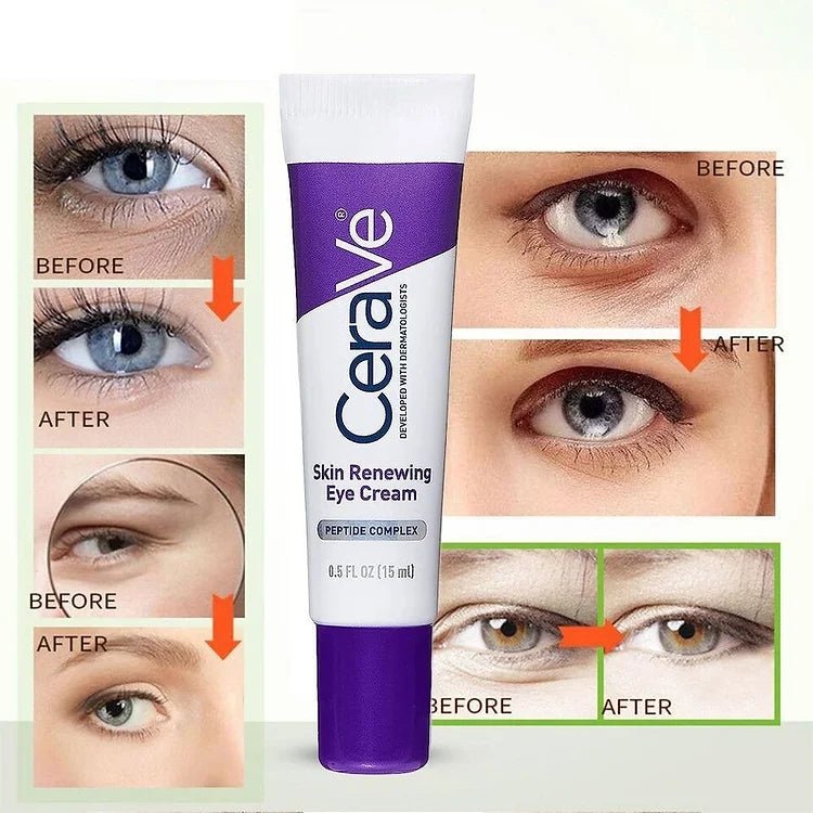 Skin Renewing Eye Cream - Zambeel