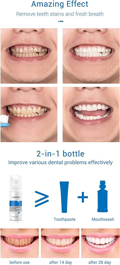 Teeth Whitening Mousse - Zambeel